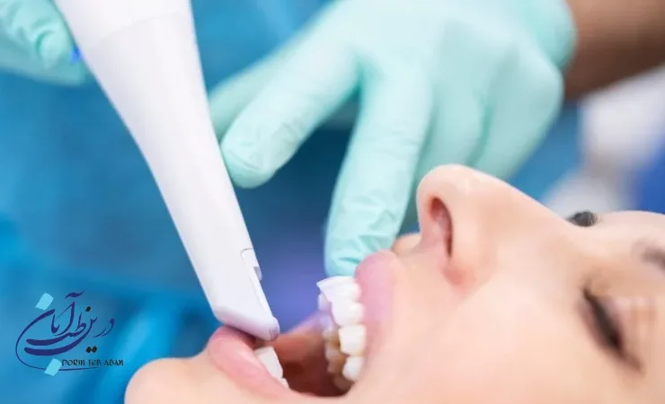 تفاوت قالب‌گیری سنتی و اسکنر دهانی دیجیتال چیست؟ | مقایسه کامل این دو روش
