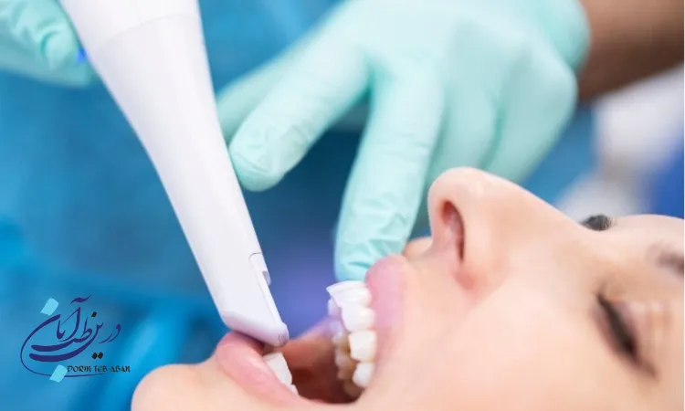 تفاوت قالب‌گیری سنتی و اسکنر دهانی دیجیتال چیست؟ | مقایسه کامل این دو روش